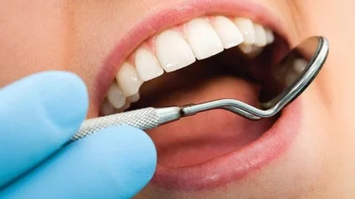 Gengivite: conheça o problema, as causas e o tratamento