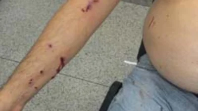Laerte Vasconcelos é baleado durante tentativa de roubo