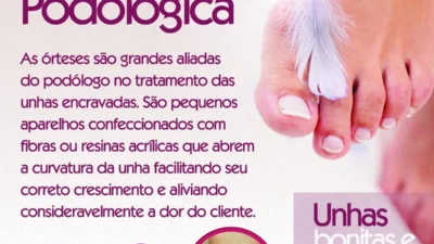 Saiba como acabar com o sofrimento das unhas encravadas