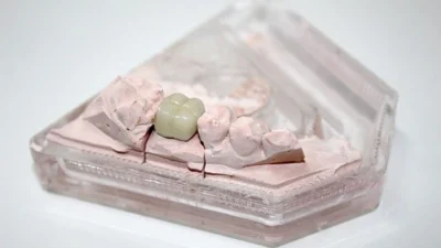 Limpeza anual promove dentes mais saudáveis na velhice
