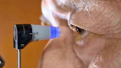 Conheça o que é o Glaucoma e quais são os tratamentos