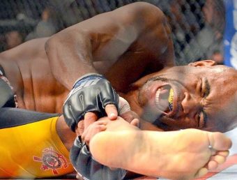 Osso da tíbia é o segundo maior do corpo humano; lutador Anderson Silva também o fraturou