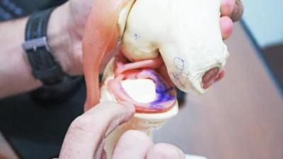 Exercícios adequados previnem possíveis traumas no joelho