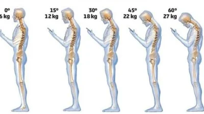 Inclinação do pescoço para o uso do celular sobrecarrega a coluna