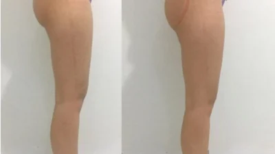 Magic Pump: é a tendência entre as mulheres no calor