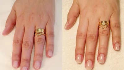 Conheça os alongamentos artificiais para as unhas