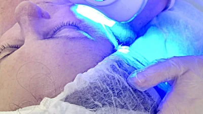 Conheça os benefícios da Criolipólise e Oxigenioterapia