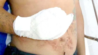 Baleado em troca de tiros com a PM presta depoimento