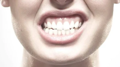 Bruxismo leva ao desgaste dental e quebra de próteses