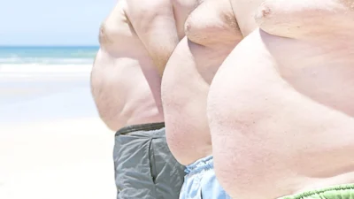 Obesidade cresce no Brasil tal  como casos de diabetes e hipertensão