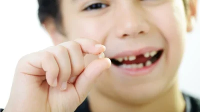 Não esfoliação dentária no período de infância pode causar problemas na arcada dentária