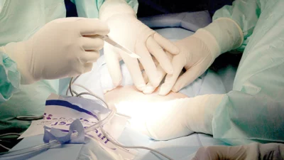 Mamoplastia de aumento harmoniza o  corpo e resulta na melhoria da autoestima