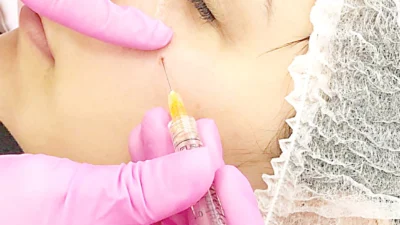 Harmonização facial através da Odontologia