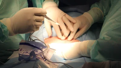 Abdominoplastia ou lipoaspiração? Saiba qual é a melhor para você e qual escolher