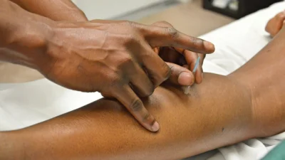 Acupuntura pode ajudar no tratamento da ansiedade