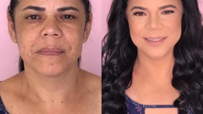 Maquiagens para peles com melasma
