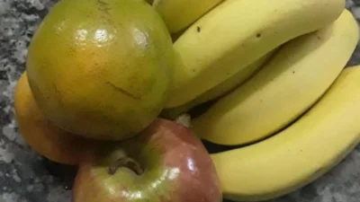 Veja a relação entre nutrição e cirurgias plásticas