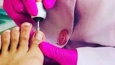 Saiba a importância do cuidado com os pés