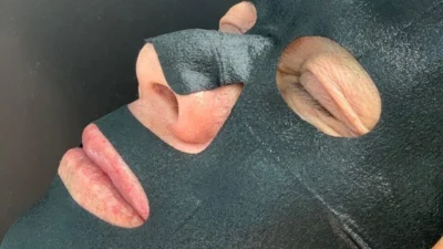Saiba mais sobre a harmonização facial em homens