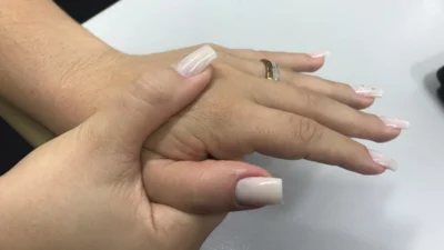 Rizartrose: confira as causas, sintomas e tratamento