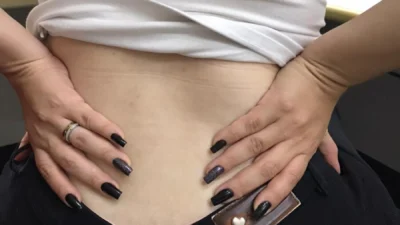 Ortopedistas falam sobre o uso da acupuntura no tratamento de dores crônicas