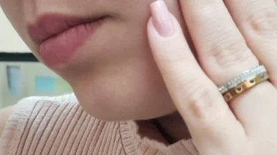 A importância de extrair o dente do siso