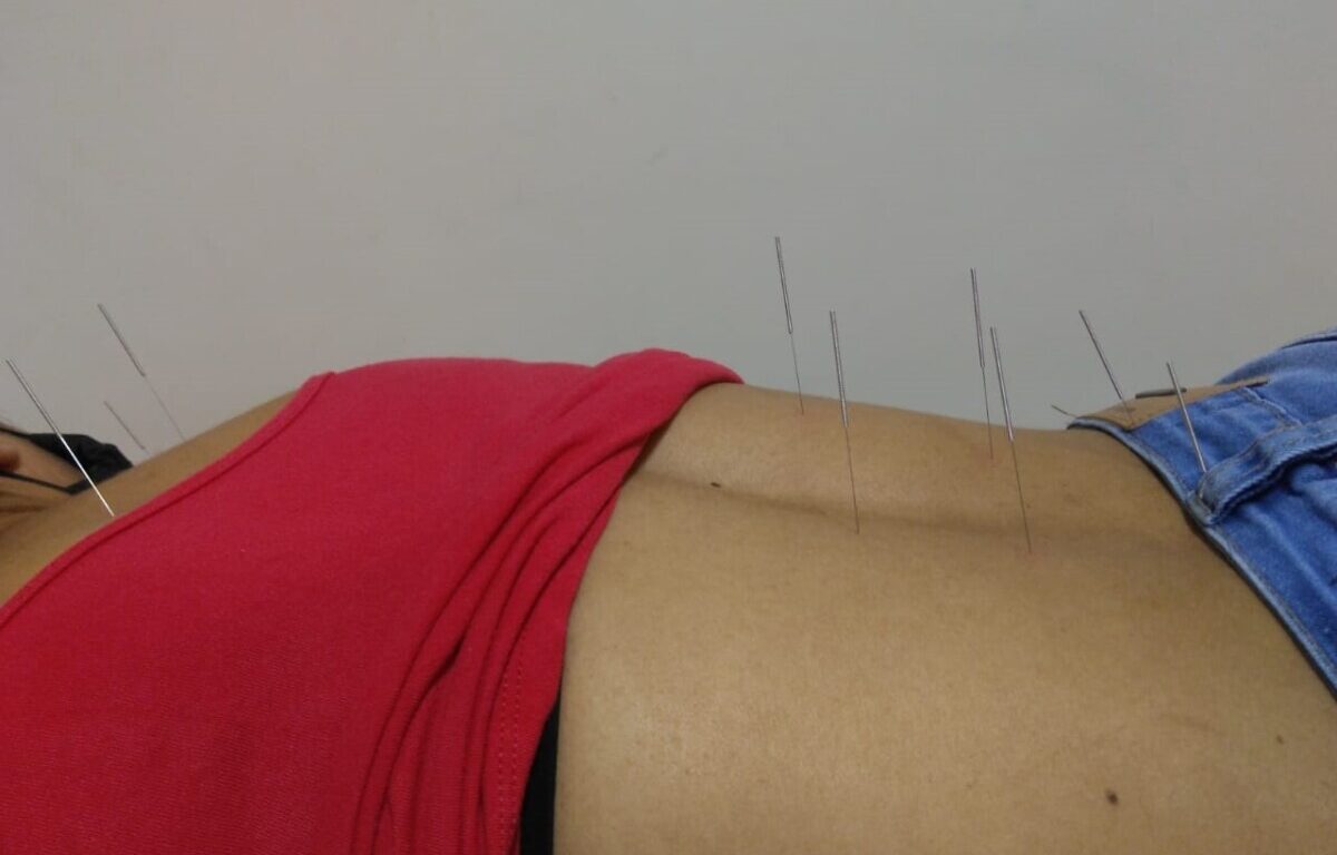 Papel da Acupuntura no tratamento da ansiedade, depressão e síndrome do ...