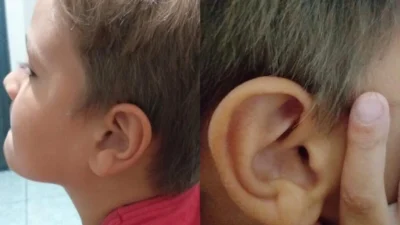 Entenda o desenvolvimento auditivo infantil