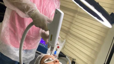 Saiba mais sobre a remoção a laser de tatuagens e a micropigmentação