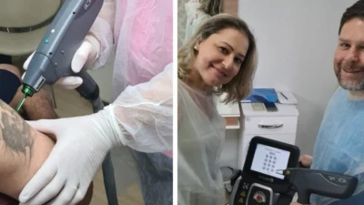 Técnicas utilizadas para remoção de tatuagens e despigmentação
