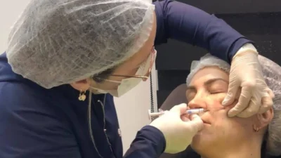 Como funciona e quais benefícios para aplicar Bioestimulador de Colágeno