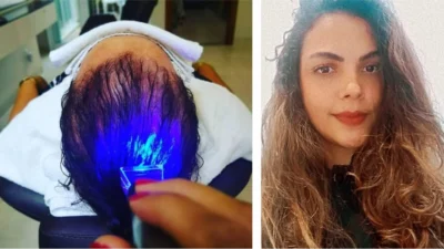 Luz de Led Azul: conheça seus benefícios para o tratamento capilar
