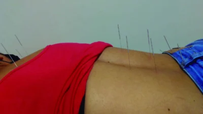 Acupuntura no tratamento das síndromes respiratórias do Outono e Inverno