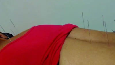 Como a acupuntura pode ajudar no tratamento da ansiedade