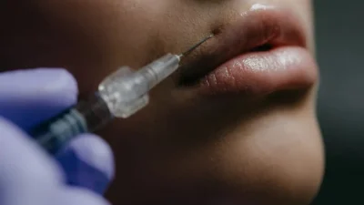 Conselho Federal de Medicina solicita proibição do PMMA em procedimentos estéticos