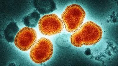 Campinas confirma primeira morte por gripe em 2025