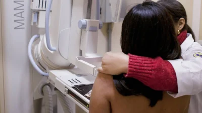 Senado aprova projetos que ampliam acesso à mamografia a partir dos 30 anos