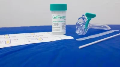 SUS oferece teste nacional para detectar HPV e prevenir câncer do colo do útero