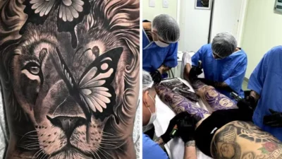 CFM proíbe anestesia geral e sedação para tatuagem, mas pomadas seguem liberadas; entenda ponto a ponto