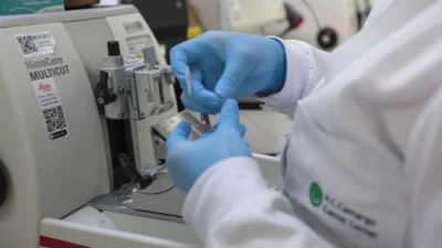 Cura de câncer de próstata pode chegar a até 98%
