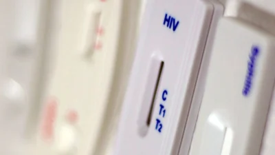 Anvisa aprova novo medicamento para prevenção do HIV no Brasil