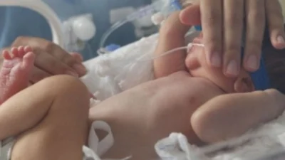 Nirsevimabe chega a Paulínia e reforça proteção contra vírus respiratório em bebês