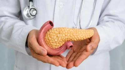 Câncer de pâncreas: doença silenciosa exige atenção aos sinais de alerta