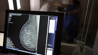 Planos de saúde terão que cobrir mamografia digital para todas as idades